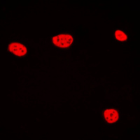 3 - Anti-TCEB3C Antibody AP51550