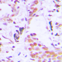 19 - Anti-TCEB3C Antibody AP51550