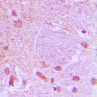 19 - Anti-TCF3 Antibody AP51551