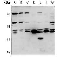 1 - Anti-TCF7 Antibody AP51552