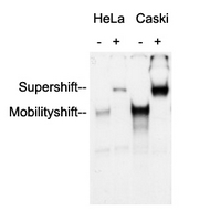 26 - Anti-AP2 alpha/beta Antibody AP51553
