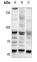 1 - Anti-AP2 alpha/beta Antibody AP51553