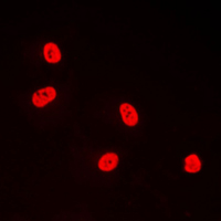 3 - Anti-TFDP1 Antibody AP51554