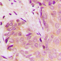 19 - Anti-TGF beta 1 Antibody AP51556
