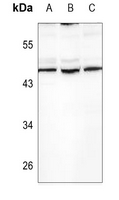 1 - Anti-TGF beta 2 Antibody AP51557