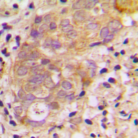 19 - Anti-TGF beta 3 Antibody AP51558