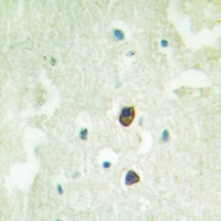 19 - Anti-TGFBR2 (Phospho-S225) Antibody AP51559