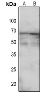 1 - Anti-TGFBR2 (Phospho-S225) Antibody AP51559
