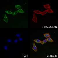 3 - Anti-TGFBR2 Antibody AP51560