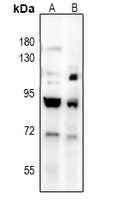 1 - Anti-TGFBR2 Antibody AP51560