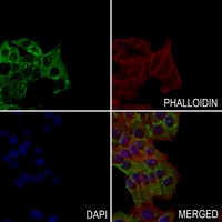 3 - Anti-Transglutaminase 2 Antibody AP51561