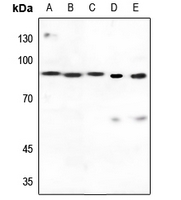 1 - Anti-Transglutaminase 2 Antibody AP51561