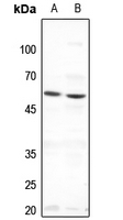 1 - Anti-THRA Antibody AP51562