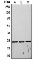 1 - Anti-TIMP4 Antibody AP51565