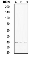 1 - Anti-TIN2 Antibody AP51566