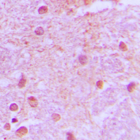 19 - Anti-TLE4 Antibody AP51567
