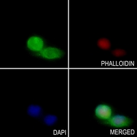 3 - Anti-TLK1 Antibody AP51568