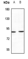 1 - Anti-TLK1 Antibody AP51568