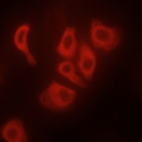 3 - Anti-TNF alpha Antibody AP51569