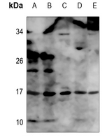 1 - Anti-TNF alpha Antibody AP51569