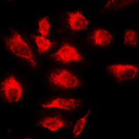 3 - Anti-A20 Antibody AP51570
