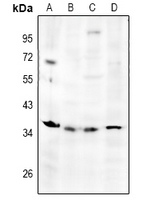 1 - Anti-TSG6 Antibody AP51571