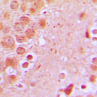 19 - Anti-SCC-S2 Antibody AP51572