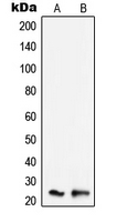 1 - Anti-SCC-S2 Antibody AP51572