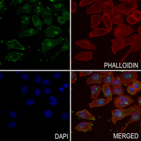 3 - Anti-CD120a Antibody AP51573