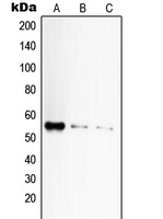 1 - Anti-CD120a Antibody AP51573