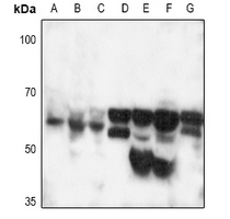 1 - Anti-CD120b Antibody AP51574