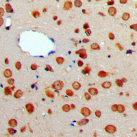 19 - Anti-CD256 Antibody AP51575