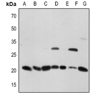 1 - Anti-CD256 Antibody AP51575