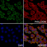 3 - Anti-Tensin 1 (Phospho-Y1326) Antibody AP51576