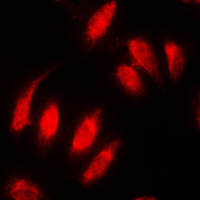 3 - Anti-Topoisomerase 2 alpha Antibody [KO/KD Validated] AP51577