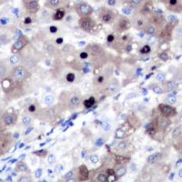 19 - Anti-Topoisomerase 2 alpha Antibody [KO/KD Validated] AP51577