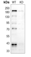 0 - Anti-Topoisomerase 2 alpha Antibody [KO/KD Validated] AP51577