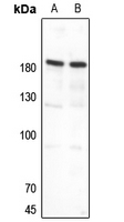 1 - Anti-Topoisomerase 2 alpha Antibody [KO/KD Validated] AP51577