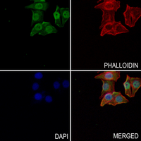 3 - Anti-Topoisomerase 2 beta Antibody AP51578