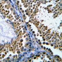 19 - Anti-Topoisomerase 2 beta Antibody AP51578
