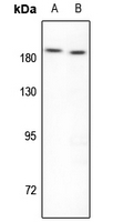 1 - Anti-Topoisomerase 2 beta Antibody AP51578