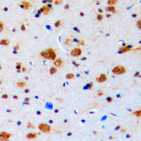 19 - Anti-Topoisomerase 3 beta1 Antibody AP51579