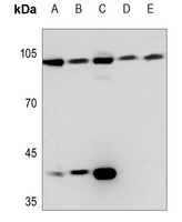 1 - Anti-Topoisomerase 3 beta1 Antibody AP51579