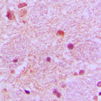 19 - Anti-TP53INP1 Antibody AP51581