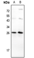 1 - Anti-TP53INP1 Antibody AP51581