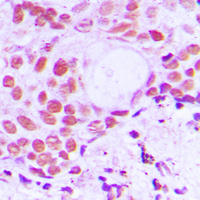 19 - Anti-TIF1 alpha Antibody AP51587