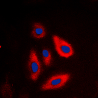 3 - Anti-TSC2 (Phospho-T1462) Antibody AP51590