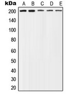 1 - Anti-TSC2 (Phospho-T1462) Antibody AP51590