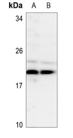 1 - Anti-TSC22 Antibody AP51591