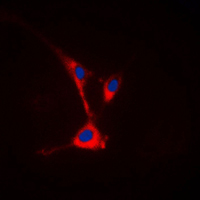 3 - Anti-TUSC3 Antibody AP51593